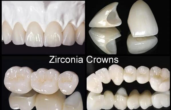 zirconia dental crown